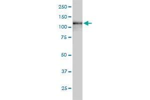 USP15 monoclonal antibody (M01), clone 1C10 Western Blot analysis of USP15 expression in HepG2 . (USP15 anticorps  (AA 1-235))