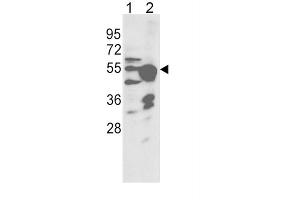 Western Blotting (WB) image for anti-Cytochrome P450, Family 2, Subfamily R, Polypeptide 1 (CYP2R1) antibody (ABIN3003559) (CYP2R1 anticorps)