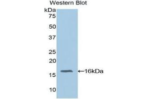 Western blot analysis of the recombinant protein. (RBP3 anticorps  (AA 1027-1229))