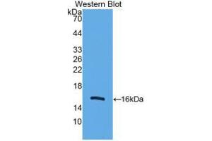 Western blot analysis of recombinant Human UCP2.