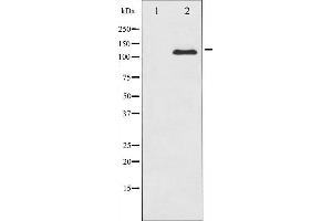 Western blot analysis of c-Kit expression in HeLa whole cell lysates,The lane on the left is treated with the antigen-specific peptide.