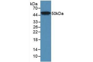 Detection of Recombinant LpPLA2, Human using Monoclonal Antibody to Phospholipase A2 Group VII (LpPLA2) (PLA2G7 anticorps  (AA 22-441))