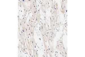 Immunohistochemical analysis of paraffin-embedded human heart tissue using A performed on the Leica® BOND RXm.