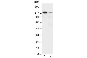 Western blot testing of Integrin alpha 3 antibody and Lane 1:  rat heart