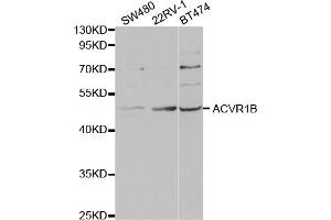 Western blot analysis of extracts of various cell lines, using ACVR1B antibody (ABIN5973168) at 1/1000 dilution. (Activin A Receptor Type IB/ALK-4 anticorps)