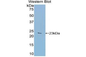 Western Blotting (WB) image for anti-Glucosidase, Alpha, Acid (GAA) (AA 782-953) antibody (ABIN1858937) (GAA anticorps  (AA 782-953))