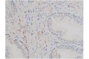 ABIN6267395 at 1/200 staining Human prostate tissue sections by IHC-P.