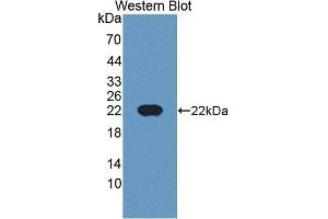 Detection of Recombinant CDKN2D, Human using Polyclonal Antibody to Cyclin Dependent Kinase Inhibitor 2D (CDKN2D) (CDKN2D anticorps  (AA 1-166))