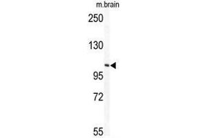 anti-TECPR1 / PALA (C-Term) antibody