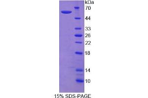 Image no. 1 for Sema Domain, Immunoglobulin Domain (Ig), Short Basic Domain, Secreted, (Semaphorin) 3E (SEMA3E) (AA 32-516) protein (His tag) (ABIN4990965) (SEMA3E Protein (AA 32-516) (His tag))
