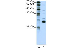 WB Suggested Anti-RCV1 Antibody Titration:  0. (Recoverin anticorps  (C-Term))
