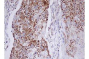 Image no. 2 for anti-Mitochondrial Translational Initiation Factor 3 (MTIF3) (AA 56-278) antibody (ABIN1491590)