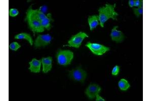 Immunofluorescence staining of MCF-7 cells with ABIN7169703 at 1:133, counter-stained with DAPI. (SIRPB1 anticorps  (Isoform 3))