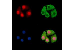ABIN7096468 and ABIN7100532 staining Hela cells by IF/ICC.