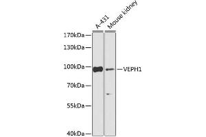 Western blot analysis of extracts of various cell lines, using VEPH1 Antibody (ABIN7271308) at 1:1000 dilution. (VEPH1 anticorps  (AA 448-547))
