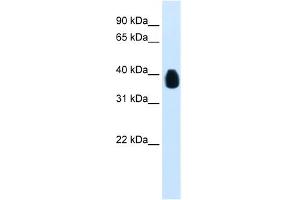 WB Suggested Anti-ETV7 Antibody Titration:  0. (ETV7 anticorps  (C-Term))