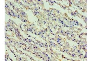 Immunohistochemistry of paraffin-embedded human lung tissue using ABIN7167479 at dilution of 1:100 (RIPK3 anticorps  (AA 1-120))