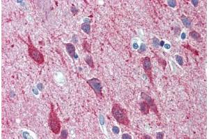 Human Brain, Cortex: Formalin-Fixed, Paraffin-Embedded (FFPE)