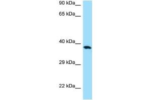 Western Blotting (WB) image for anti-CD276 (CD276) (C-Term) antibody (ABIN2789671) (CD276 anticorps  (C-Term))