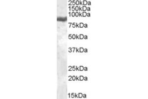 Image no. 1 for anti-Lactotransferrin (LTF) (Internal Region) antibody (ABIN375038) (Lactoferrin anticorps  (Internal Region))