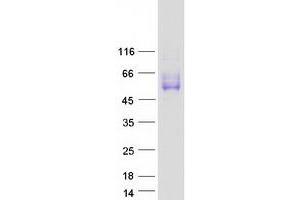 Validation with Western Blot