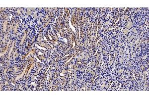 Detection of ASS1 in Rat Kidney Tissue using Polyclonal Antibody to Argininosuccinate Synthetase 1 (ASS1) (ASS1 anticorps  (AA 1-412))
