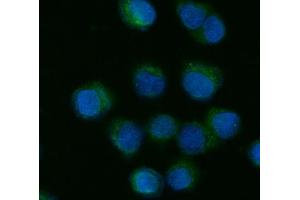 IF analysis of CYP7A1 using anti-CYP7A1 antibody (ABIN7599604).