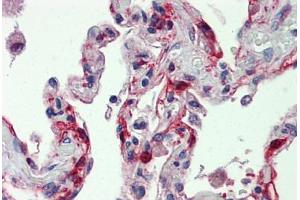 Human Lung: Formalin-Fixed, Paraffin-Embedded (FFPE) (Factor VII anticorps  (AA 209-444))