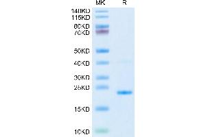 IL17B Protein (AA 21-180) (His tag)