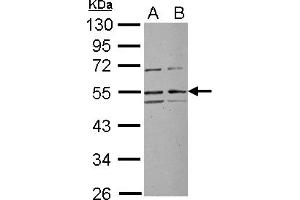 Western Blotting (WB) image for anti-Ribosomal RNA Processing 1 Homolog A (RRP1) (Internal Region) antibody (ABIN1496142) (RRP1 anticorps  (Internal Region))