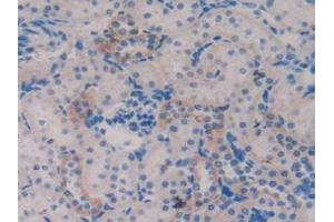 Detection of TFF3 in Rat Kidney Tissue using Polyclonal Antibody to Trefoil Factor 3 (TFF3) (TFF3 anticorps  (AA 23-81))