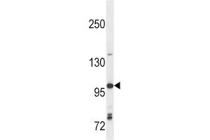 Western Blotting (WB) image for anti-Toll-Like Receptor 7 (TLR7) antibody (ABIN2998417)