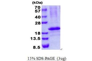 Image no. 1 for RCAN Family Member 3 (RCAN3) (AA 56-241) protein (His tag) (ABIN1098701)