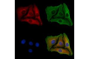 ABIN6258178 and ABIN6273873 staining Hela cells by IF/ICC. (GPR39 anticorps  (C-Term))