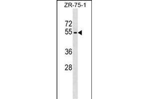 PLD4 Antibody (N-term) (ABIN1539414 and ABIN2849223) western blot analysis in ZR-75-1 cell line lysates (35 μg/lane). (Phospholipase D4 anticorps  (N-Term))