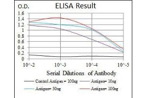 Black line: Control Antigen (100 ng), Purple line: Antigen(10 ng), Blue line: Antigen (50 ng), Red line: Antigen (100 ng),