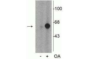 Western blot of PC-12 cell lysate incubated in the absence (-) and presence (+) of okadaic acid (OA, 1 µM for 60 min)  showing specific immunolabeling of the ~60 kDa tyrosine hydroxylase phosphorylated at Ser31. (Tyrosine Hydroxylase anticorps  (pSer31))