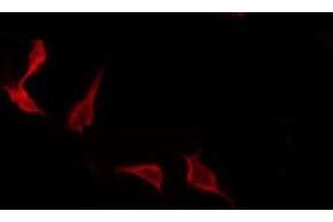 ABIN6275210 staining COLO205 by IF/ICC.