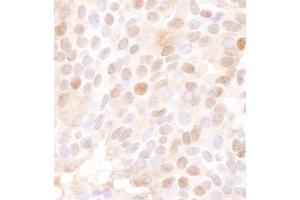 anti-Minichromosome Maintenance Deficient 4 (MCM4) (AA 325-375) antibody