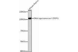 Western blot analysis of extracts of Mouse thymus, using DNA topoisomerase I (DNA topoisomerase I (TOP1)) Rabbit mAb (ABIN7270850) at 1:1000 dilution.