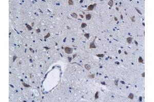 Formalin-fixed and paraffin embedded rat brain labeled with Anti-Phospho-Lyn (Tyr396) Polyclonal Antibody, Unconjugated (ABIN743618) followed by conjugation to the secondary antibody and DAB staining (LYN anticorps  (pTyr397))