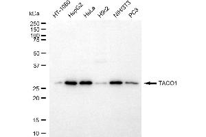 Western blotting analysis using TACO1 antibody (ABIN7798113).