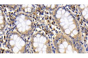 Detection of BCL2L11 in Human Colon Tissue using Polyclonal Antibody to Bcl2 Like Protein 11 (BCL2L11)