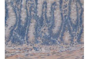 DAB staining on IHC-P; Samples: Rat Intestine Tissue