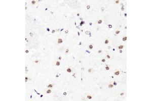 Immunohistochemistry of paraffin-embedded rat brain using H3R2me2a antibody.