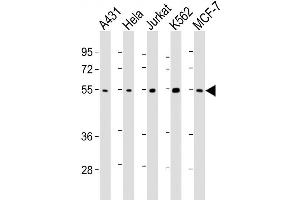 Lane 1: A431, Lane 2: HeLa, Lane 3: Jurkat, Lane 4: K562, Lane 5: MCF-7 cell lysates at 20ug per lane, probed with bsm-51266M CHK1 (2G1D5) Monoclonal Antibody at 1:1000 overnight at 4°C followed by a conjugated secondary antibody for 60 minutes at 37°C. (CHEK1 anticorps)