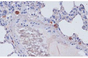 Immunohistochemistry of paraffin-embedded Rat lung using Perforin Polyclonal Antibody at dilution of 1:100 (40x lens). (Perforin 1 anticorps)