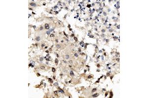 IHC analysis of MNT using anti-MNT antibody (ABIN7601555). (MNT anticorps  (AA 381-564))