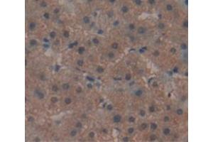 IHC-P analysis of Human Tissue, with DAB staining. (REV1 anticorps  (AA 301-478))