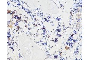 Immunohistochemistry analysis of paraffin-embedded mouse bone using BGLAP Polyclonal Antibody at dilution of 1:100. (Osteocalcin anticorps)